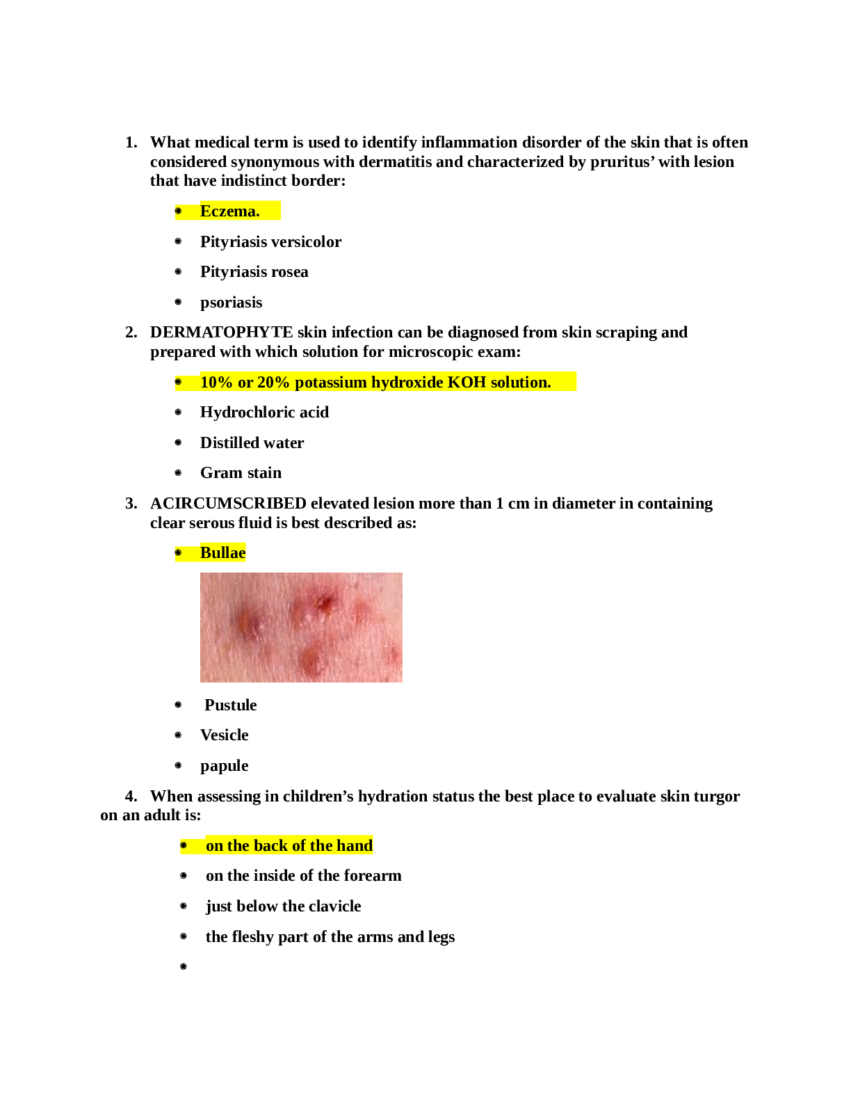 Preview image for NSG 6435_Final_review_Exam_Peds.(LATEST)ALL ANSWERS VERIFIED,100%